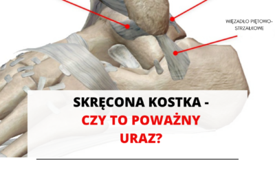 SKRĘCENIE STAWU SKOKOWEGO – CZY TO POWAŻNY URAZ?